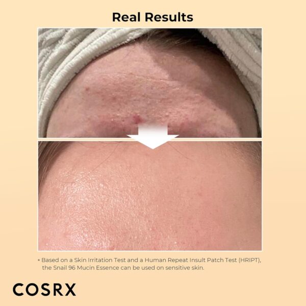 COSRX Snail Mucin 96% Power Repairing Essence 3.38 fl.oz 100ml, Hydrating Serum for Face with Snail Secretion Filtrate for Dull Skin & Fine Lines, Korean Skin Care - Image 5